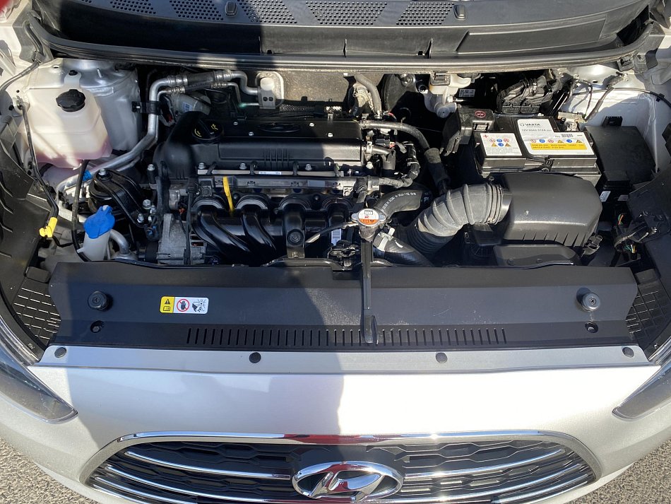 Hyundai Ix20 1.6 CVVT 